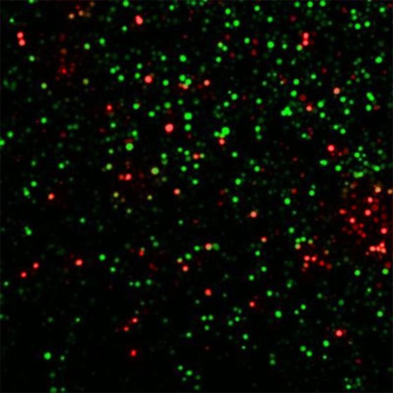 Zunanja svetilka Globo Meriton